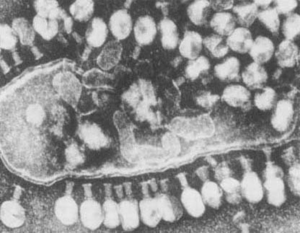 Semmelweis Discovers Disease Control