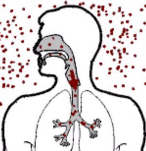 Tuberculosis bacillus is discovered by Koch