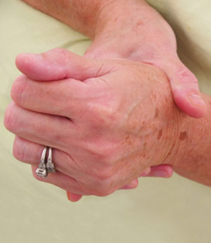 I begin to get arthritis