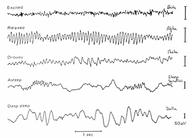 UTILIZACIÓN DEL EEG (Electroencefalografía)
