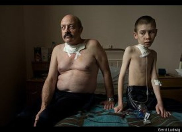 Chernobyl: the true scale of the accident