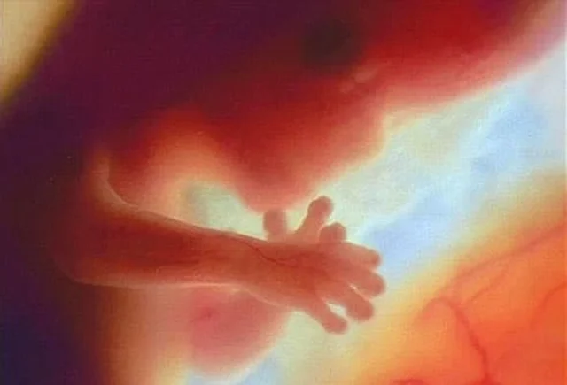 Development at 12 Weeks