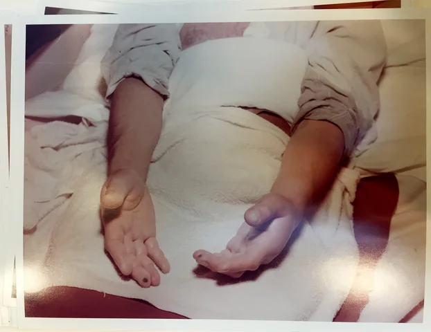 The Fate of Louis Slotin