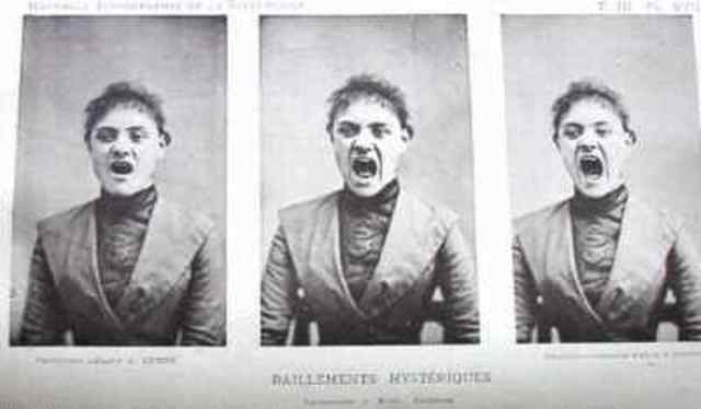 Jean-Martin Charcot and hysteria
