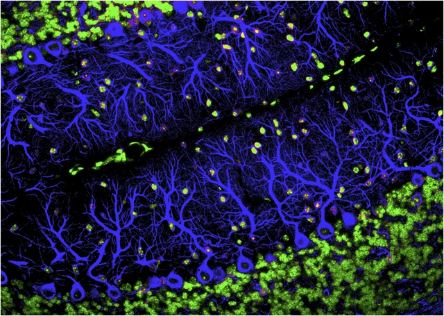 Synaptic Pruning + Video (Continues Through Age 2)