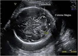 Major Developments in the Babies Brain