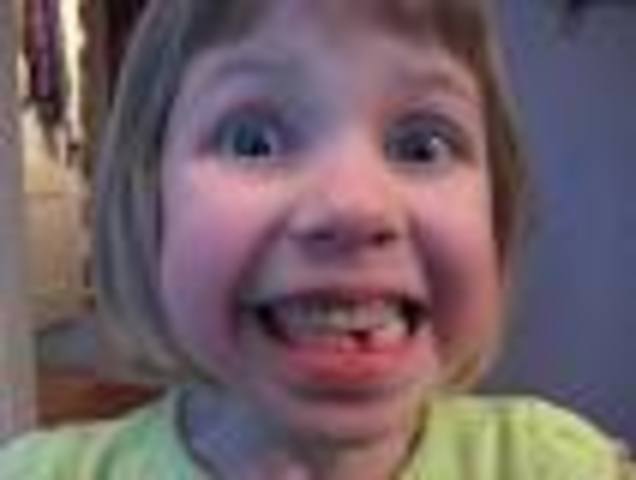 lost tooth
