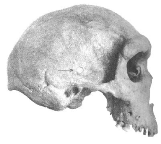 Homo cepranensis  - 800000 años