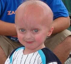 Primeras Leyes de Educación Especial