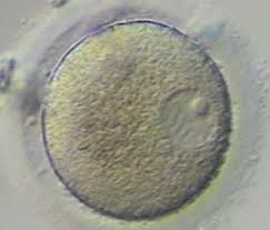 Oocyte