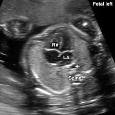 Heart Chamber Developing
