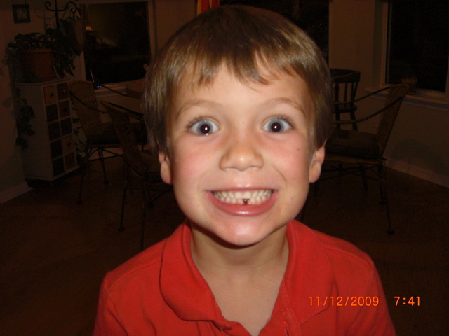 I lost my first tooth!!