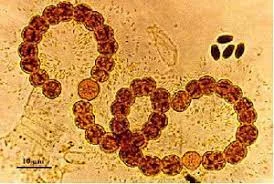 La teoría microbiana