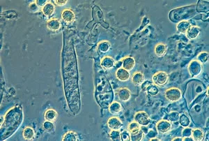 La teoría microbiana sin Pasteur y Koch