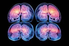 Avances en técnicas de imagen (desde 1990)