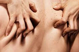 Ban on Explicit Content (and Reversal)