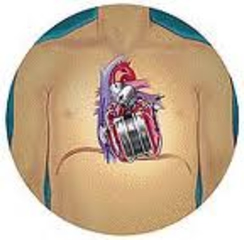 Η ΠΡΩΤΗ ΤΕΧΝΙΤΗ ΚΑΡΔΙΑ