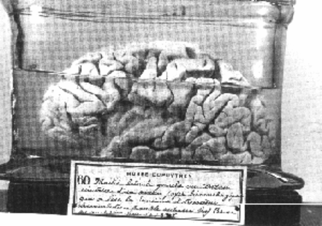 Paul Broca validates the importance of  the left frontal lobe in language