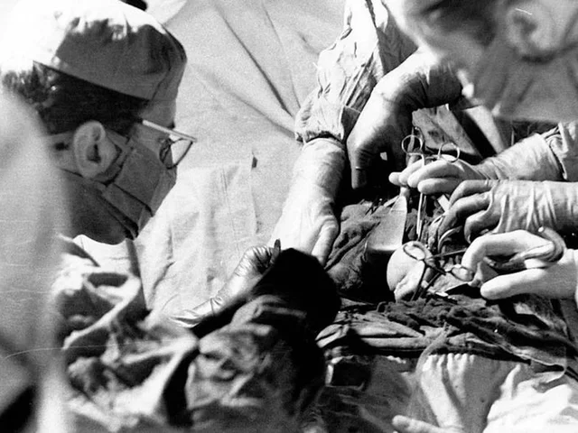 Noiz izan zen espainako lehen trasplantea ?