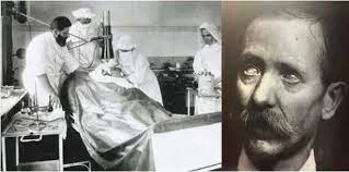 Noiz izan zen korneako lehen transplantea?