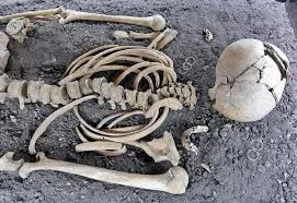 Forensic Pathology First Used