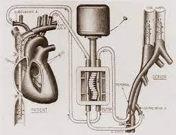 Heart-Lung Bypass Machine