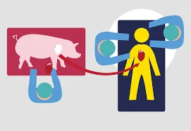 Pig Heart into a Human