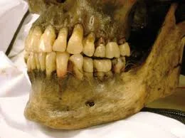 Forensic Odontology Being Used