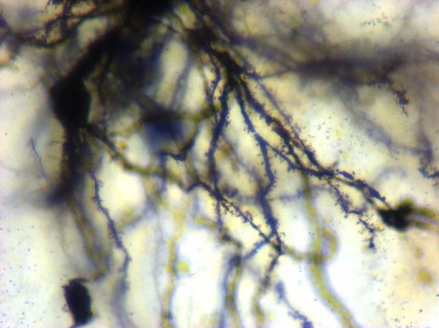 Camillo Golgi awarded nobel prize