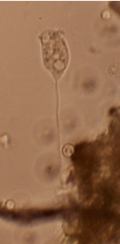 Antony van Leeuwenhoek