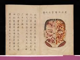 Empidemia de Viruela del 735-737