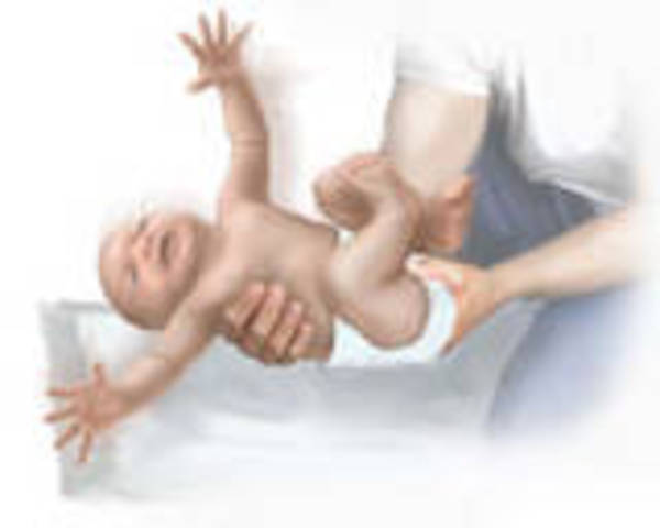 Ernst Moro Discovers the “Moro Reflex” In Infants
