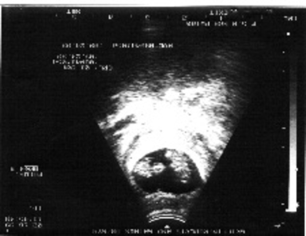 Heart beats regularly.  Eyes and ears begin to form.