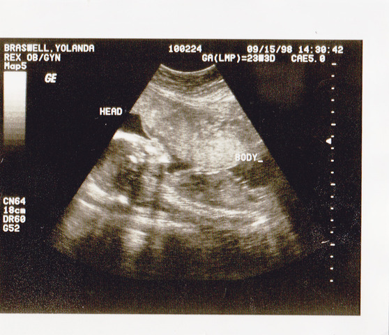 Eyelids can open and weight can be up to 6.6 pounds.