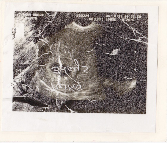 Heart beats regularly.  Eyes and ears begin to form.