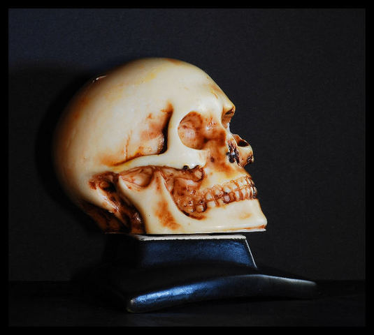 Bones are visible.  Heartbeat can be heard with a stethoscope.