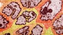 Timeline: Cancer Screenings