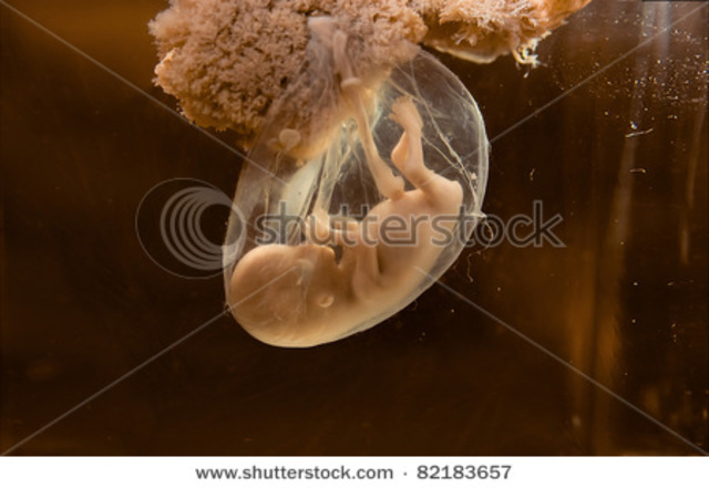 Bones are visible. Heartbeat can be heard with a stethoscope.