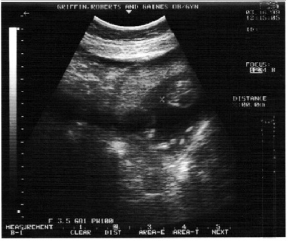 Bones are visible.  Heartbeat can be heard with a stethoscope.