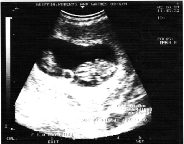 Heart develops right and left chambers.