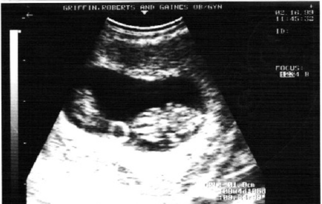 Heart beats regularly.  Eyes and ears begin to form.