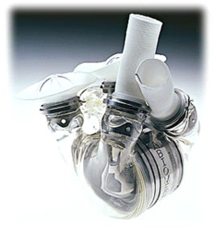 Τεχνητή Καρδιά