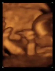 Semana 14