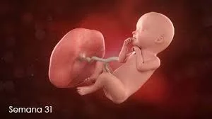 Semana 31