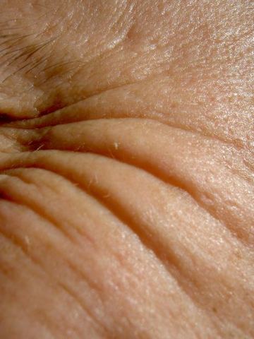Skin starts to become wrinkled.
