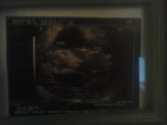 Heart beats regularly and eyes and ears form