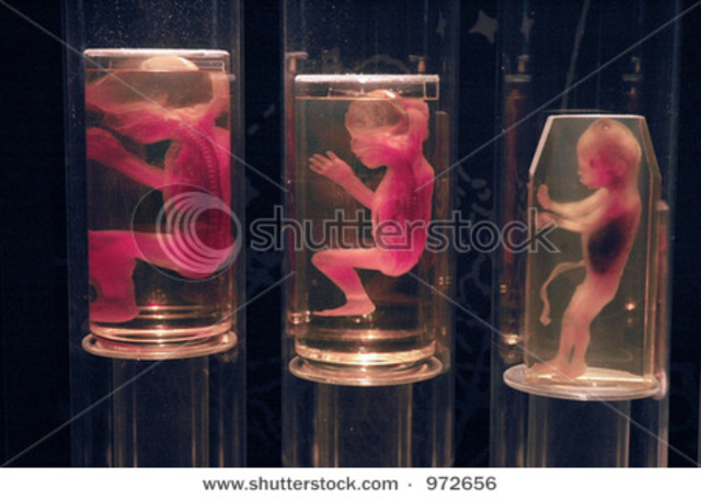 6 to 9 Month Old Fetus