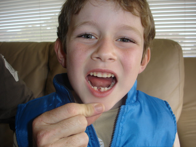 Lost my 1st tooth