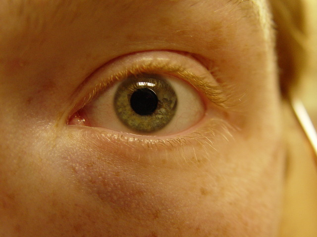 Skin starts to wrinkled