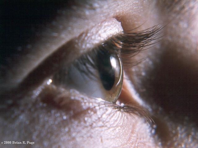 Skin starts to become wrinkled